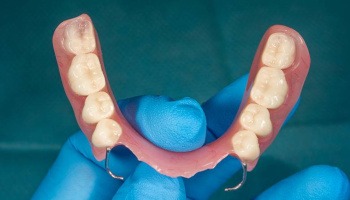 Example of partial dentures in Danville